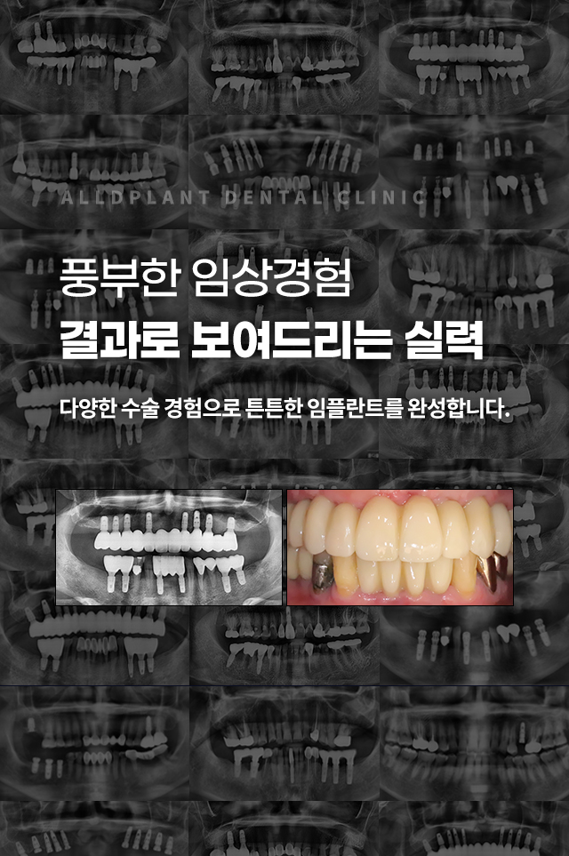 슬라이드 이미지