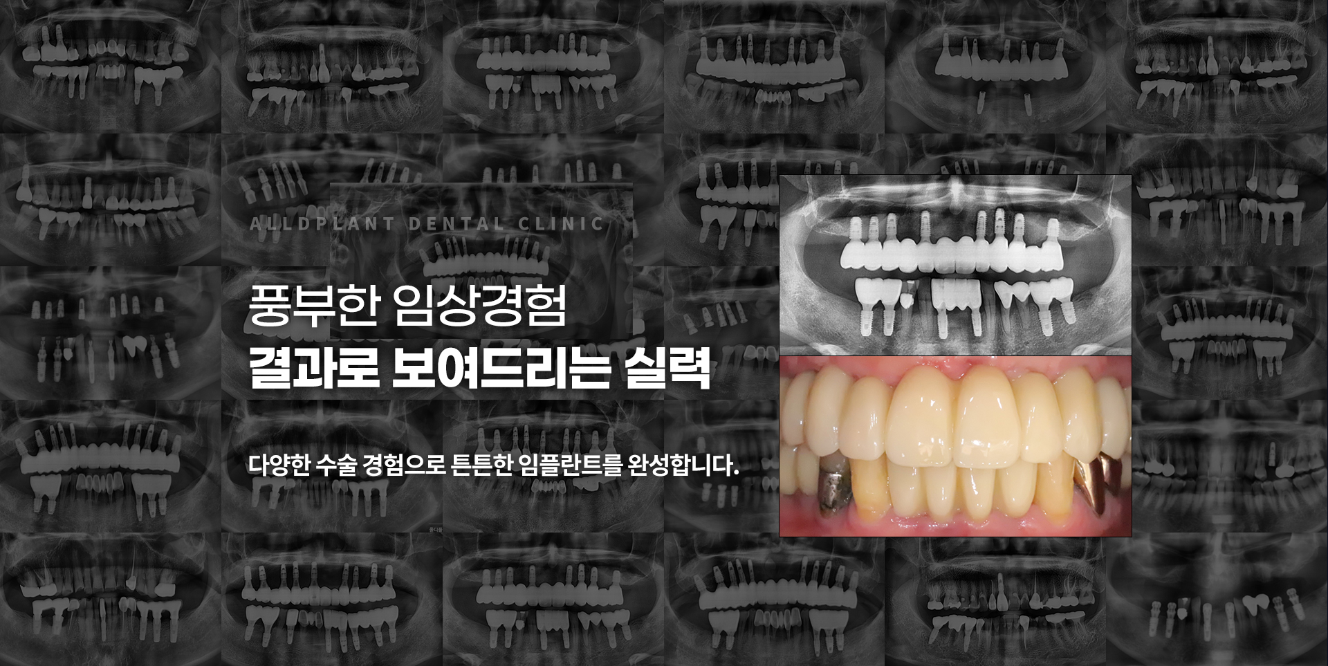 슬라이드 이미지